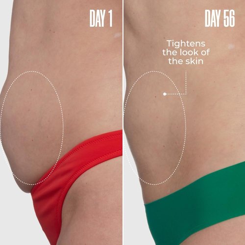 MAËLYS GET-DREAMY Overnight Toning Body Whip - Body Firming Whip That Works While You Sleep - Helps Target The Appearance Of Loose Skin On The Body