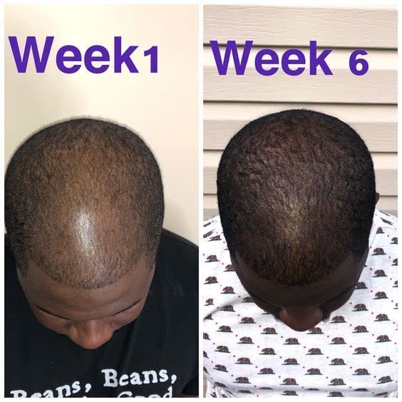 Magic Hair Growth Tonic with Ginseng – 60ML Hair Loss Treatment for Men & Women, Fast Hair Regrowth Serum for Thicker, Fuller Hair