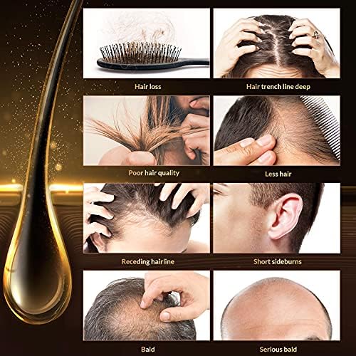 Magic Hair Growth Tonic with Ginseng – 60ML Hair Loss Treatment for Men & Women, Fast Hair Regrowth Serum for Thicker, Fuller Hair