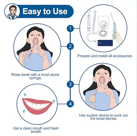 Tonsil Stone Vacuum, Tonsil Stone Remover Kit, 3X Safe Suction, 150 Degree Rotate Electronic Tonsil Stone Remover,12 in 1 Tonsil Cleaner, Oral Lamp, 5X Magnifying Mirror, Water Flosser & Syringe