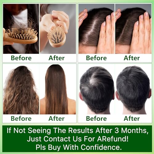 Hair Growth Shampoo and Conditioner Set w/Heat Protectant Spray,Rosemary Biotin Keratin Argan Oil Sulfate Free Routine Hair Growth Products for Thinning Hair & Hair Loss,Birthday Gifts for Women Men