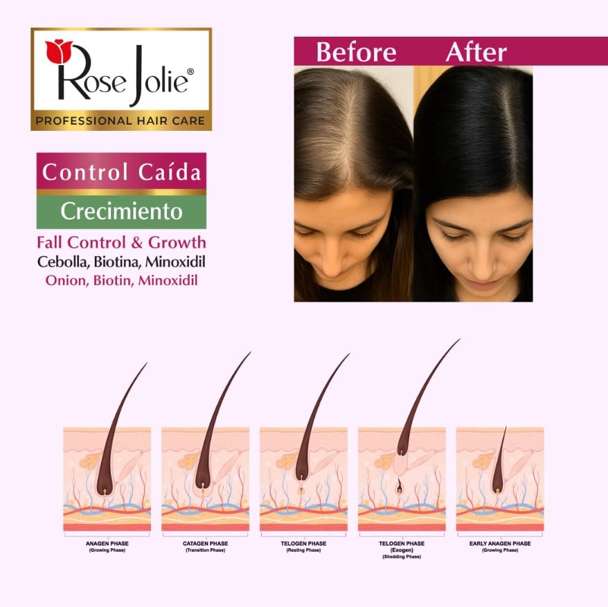 Rose Jolie Onion & Biotin Hair Tonic Spray | Fall Control & Growth Support | Strengthens Roots & Revitalizes Scalp | Sulfate-Free Salt-Free Paraben-Free | No Onion Smell | 4.5 fl oz