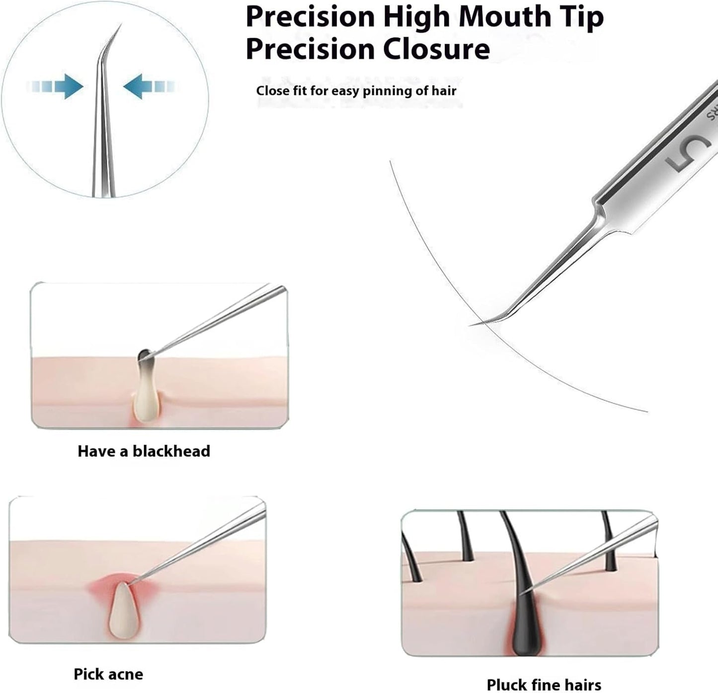 Acssart Blackhead Remover Kit - 10 Stainless Steel Tools & 15x Magnifying Glass