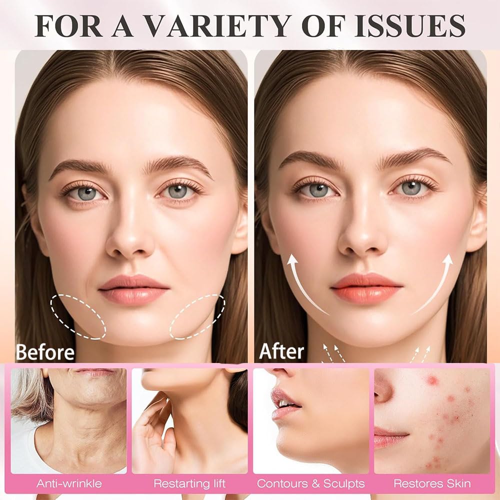 Chin Strap for Sleeping,V-Line Lifting Chin Strap, V-Line Mask,Neck Lift Jaw Tightening Exerciser Reusable Face Strap,Comfortable Effective Stop Snoring Better Than Mouth Tape for Sleeping