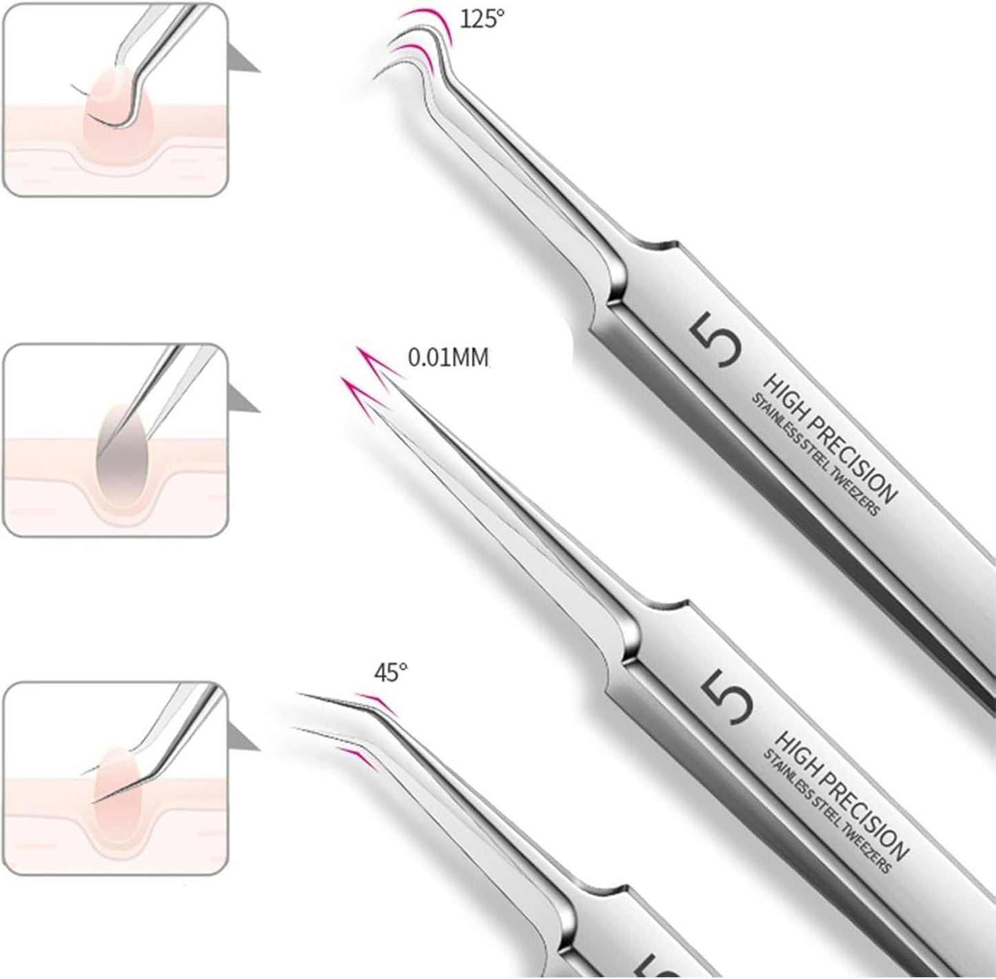 Acssart Blackhead Remover Kit - 10 Stainless Steel Tools & 15x Magnifying Glass