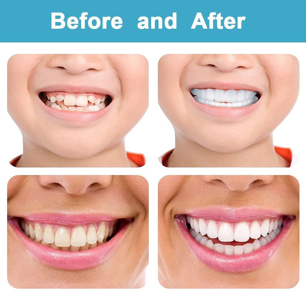 Denture Teeth Temporary Fake Teeth Snap On Top and Bottom for Men and Women, Fix Confident Smile
