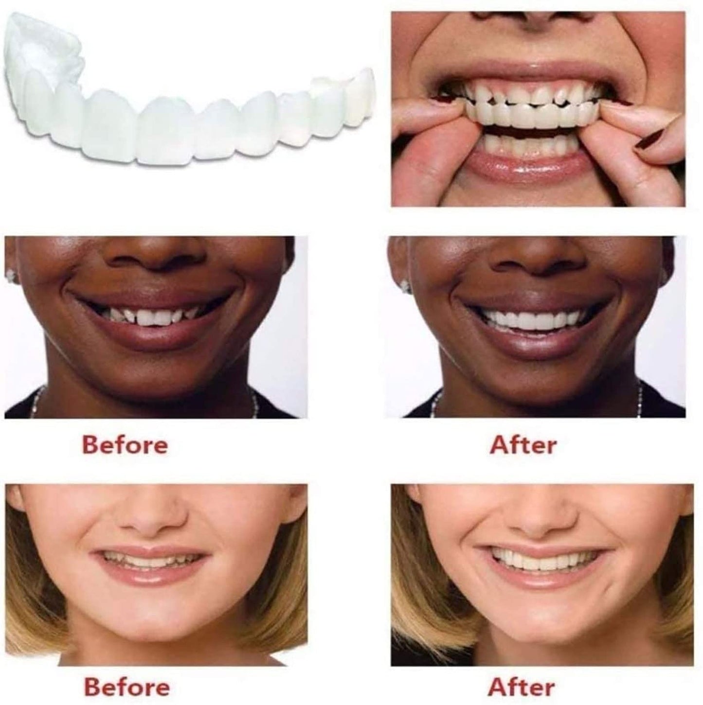 2Pairs Temporary Dentures Teeth for Women and Men, Nature and Comfortable, Protect Your Teeth and Regain Confident Smile
