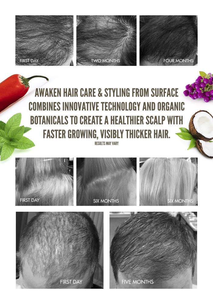 Surface Hair - Awaken Therapeutic Scalp Elixir – Natural Ingredients for Thinning Hair and a Healthy Scalp - 4 fl oz