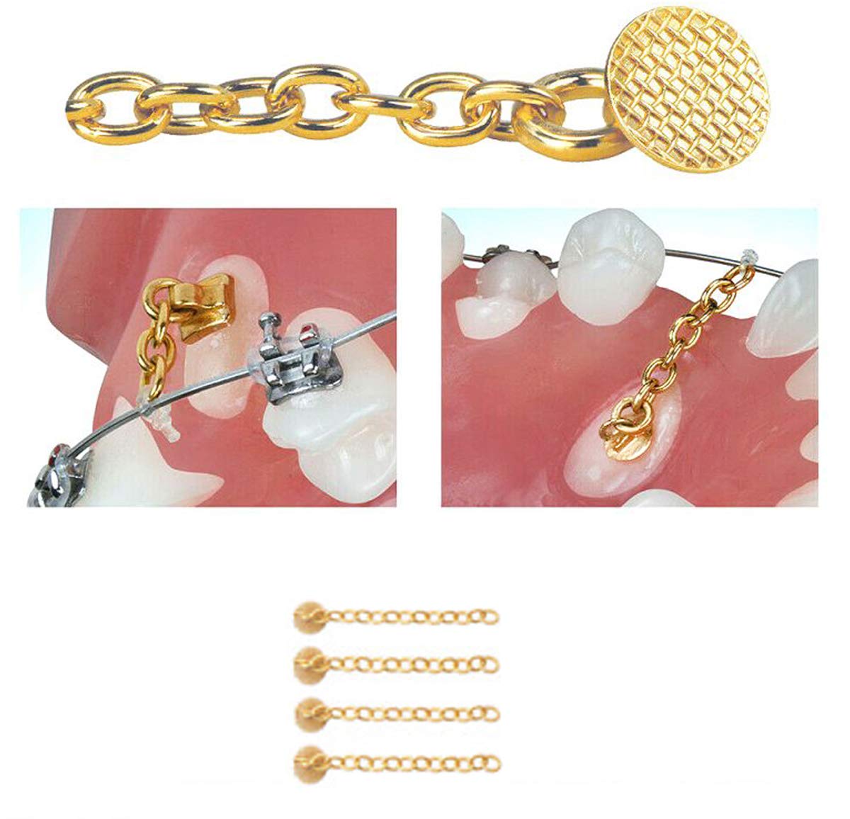 4 Pcs New Golden Traction Chain Dental Lingual Button Chains Orthodontics Materials Swivel Chain Dental Impacted Cuspid Eruption Appliance