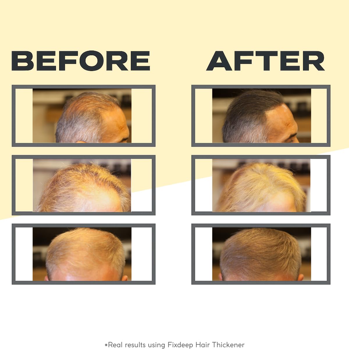 FIXDEEP Hair Thickener | New Waterproof Formula - Natural & Fuller Looking Hair in 30 sec - 14g - Fibers for Thinning, Bald Spots & Graying Roots (Dark Brown)