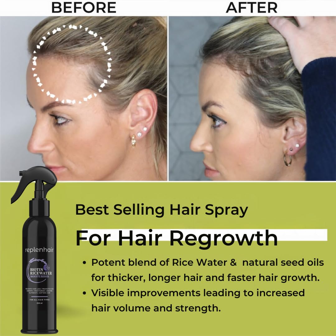 Replenhair Rice Water Biotin Hair Growth Spray - Leave In Conditioner Infused with Biotin Oil & Essential Oil for Hair Growth, Reduces Hair Fall, Dandruff & Promotes Thicker Hair - 250ml