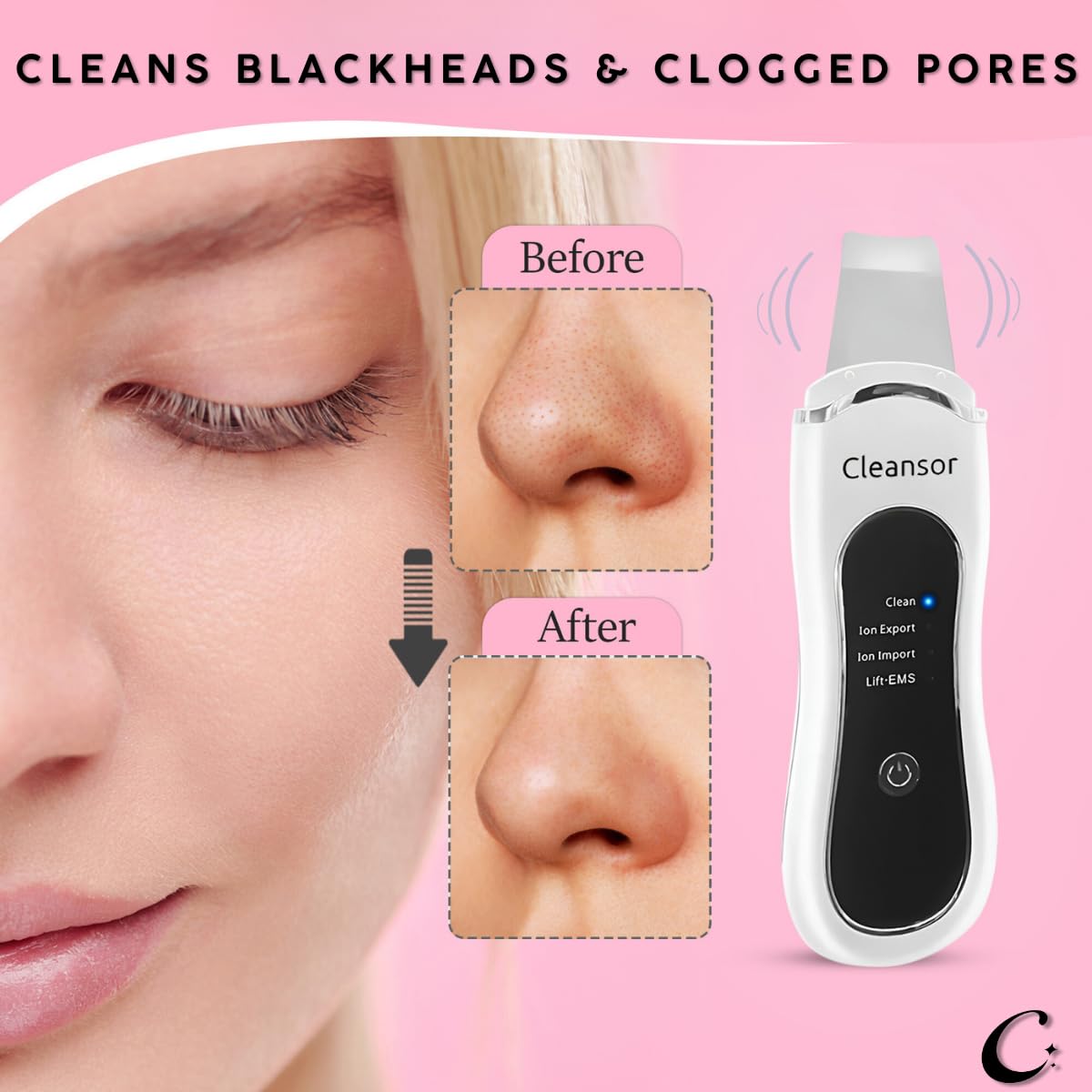 Skin Scrubber Pore Cleaner Blackhead Remover Facial Spatula with Clean, Ion and Lift Modes