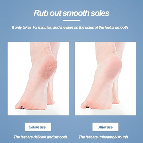 The Thai Lyfe Foot File, Beyond The Cream Foot File, Hard Skin Remover Nano-Glass Foot Filer with Non-Slip Ergonomic Handle, Professional Foot Care Tools for Smooth Feet, Remove Callous (2Pcs-Blue)