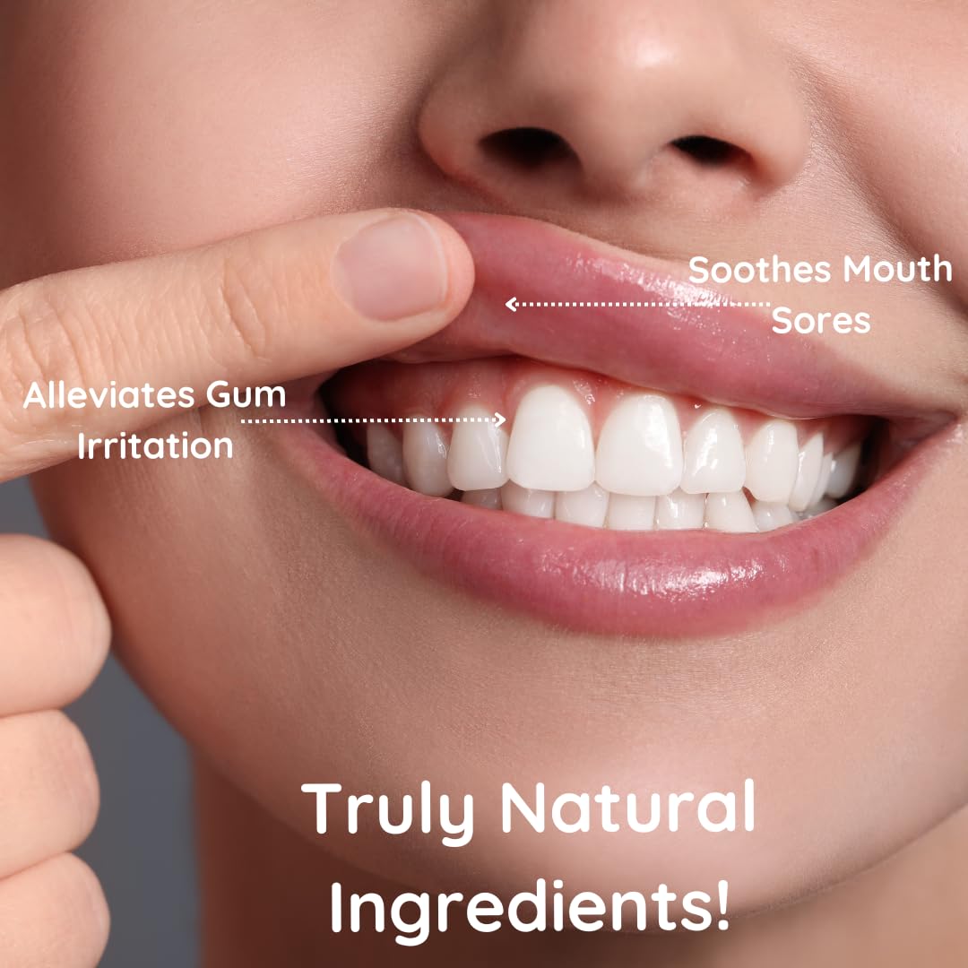Dental Herb Company - PerioSpot Mouth Sore and Gum Care Gel - Soothes and relieves discomfort from Canker sores and Gum Irritation (.5 oz.)