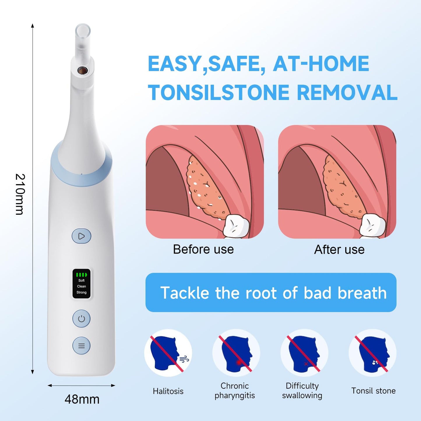 Electronic Tonsil Stone Remover with Camera, Tonsil Stone Removal Kit, 3 Suction Levels, Tonsil Stone Vacuum, Oral Care for Mouth Health, USB Rechargeable