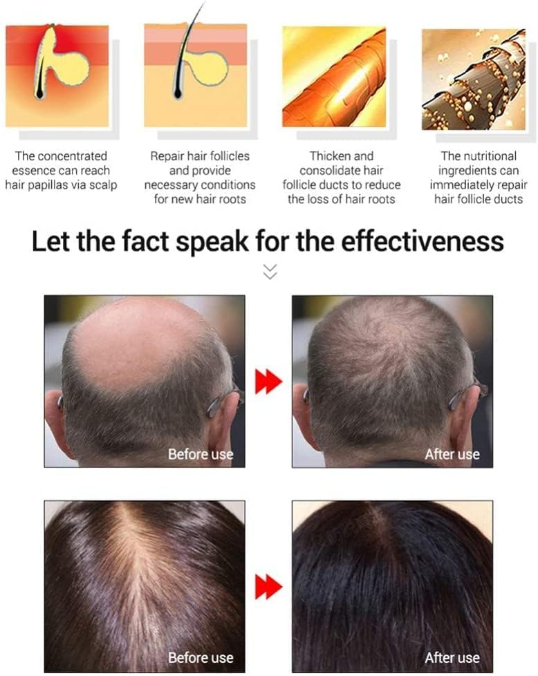 Magic Hair Growth Tonic with Ginseng – 60ML Hair Loss Treatment for Men & Women, Fast Hair Regrowth Serum for Thicker, Fuller Hair