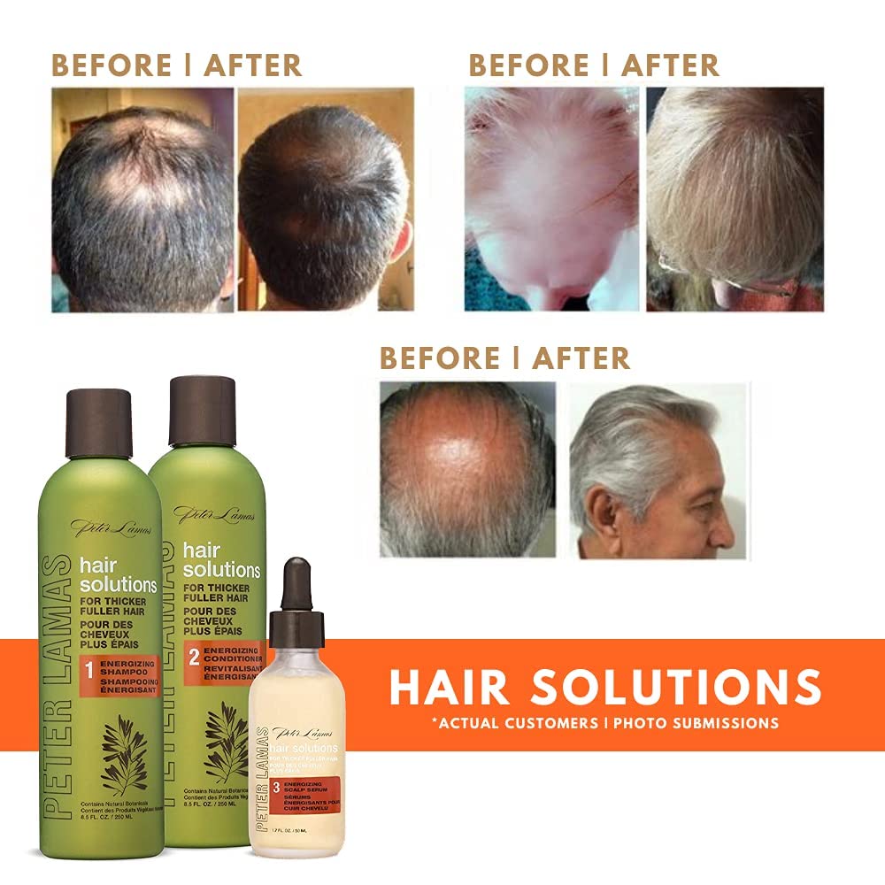 Peter Lamas Energizing Biotin & Stem Cells Scalp Serum | Hair Regrowth for Men + Women | Vegan Paraben Sulfate Free, Grow Thicker Fuller Hair by Addressing the Root Cause of Hair Loss (Pack of 2)