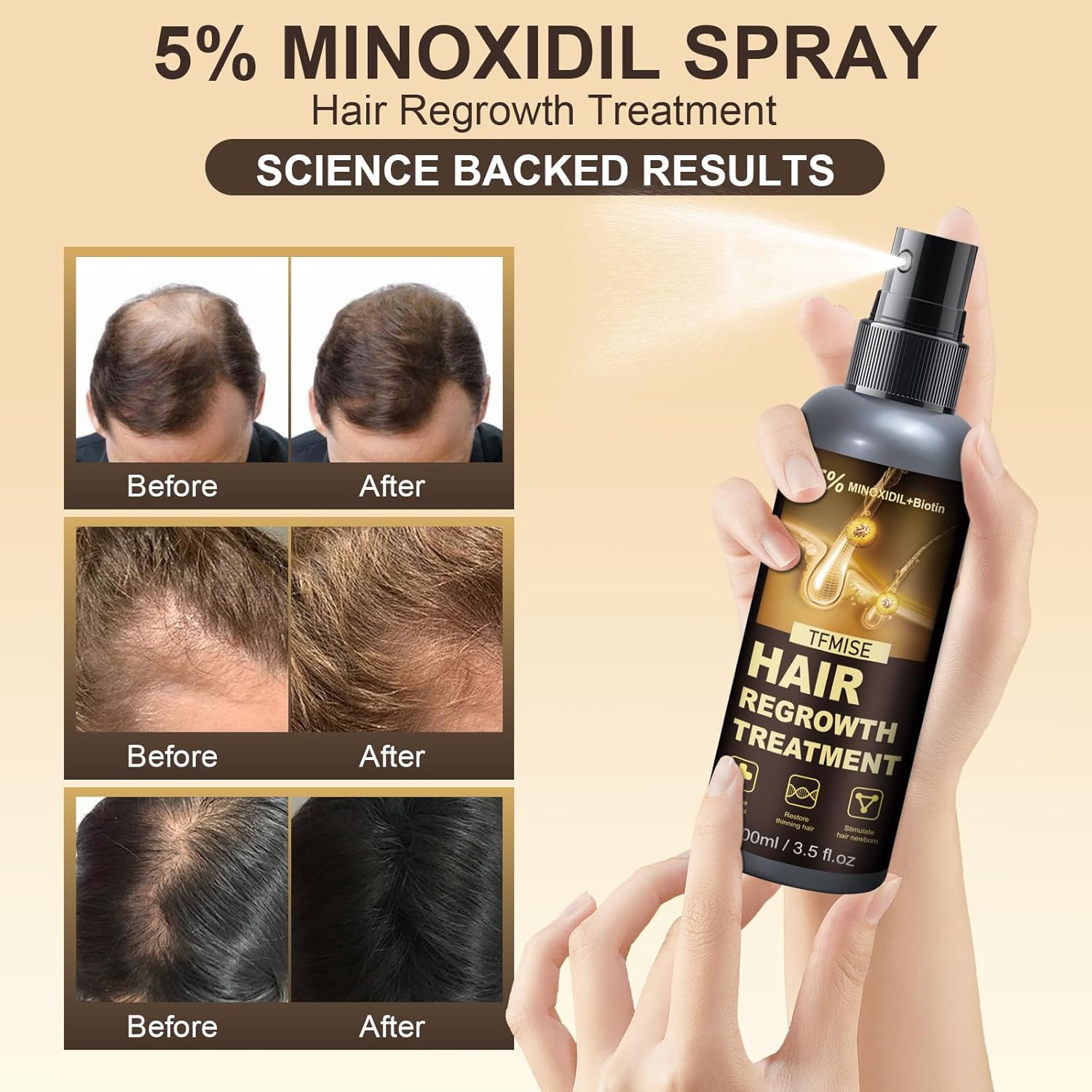 5% Minoxidil Spray for Men & Women - Extra Strength Hair Growth Solution with Biotin, 3.38 Fl. Oz