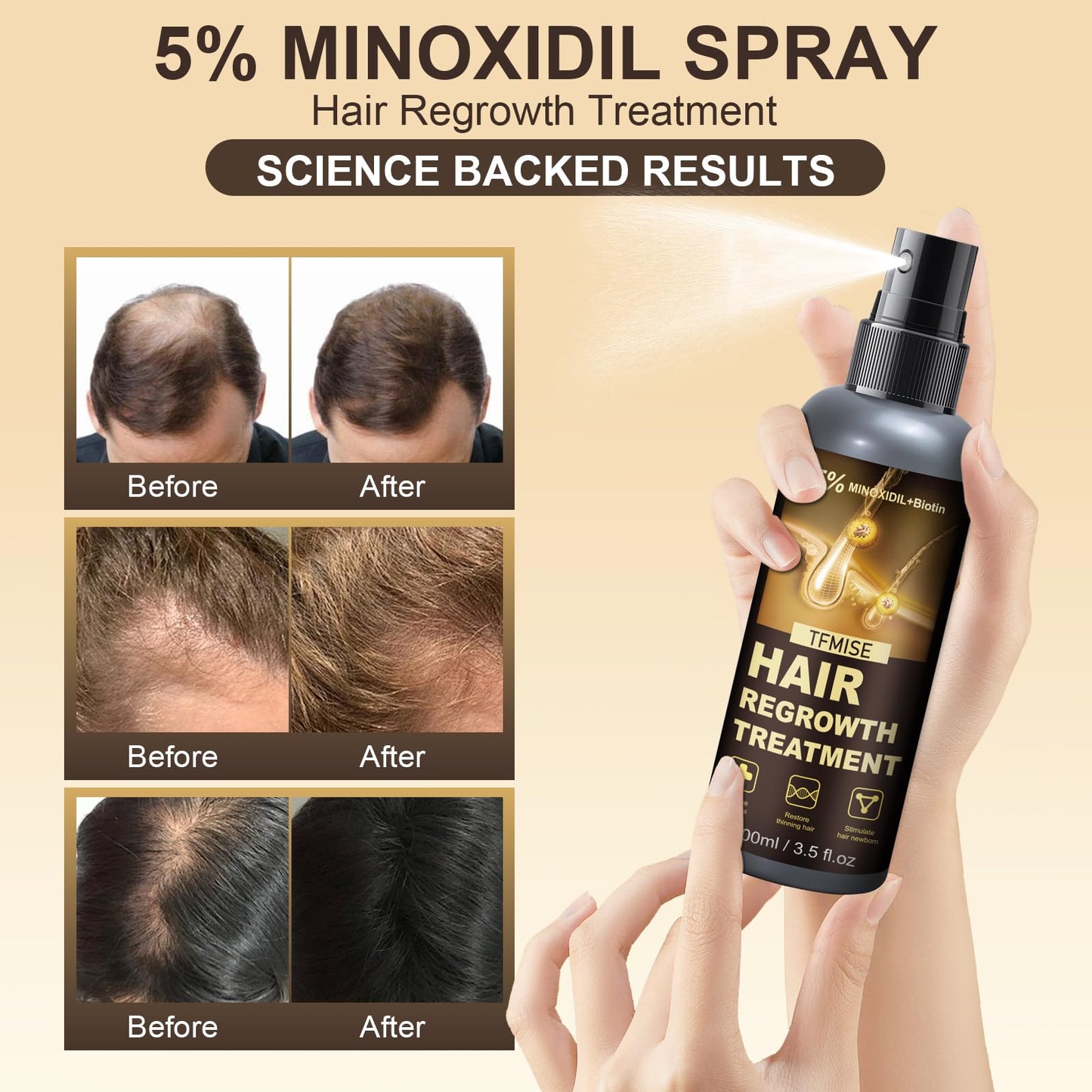 Minoxidil Spray - 5% Minoxidil for Men, Minoxidil for Women Hair Growth Products, Extra Strength Hair Regrowth Devices with Biotin, Help to Stop Loss Hair Unscented Light and non Greasy 3.38 Fl.OZ