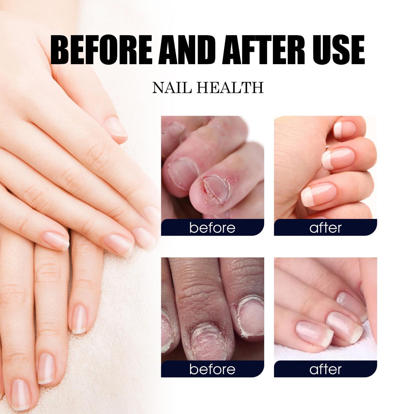 Nails Spray, for Nails Care Moisturizer, Keeps Feet Fresh & Dry All Day – Men & Women 2oz / 60ml