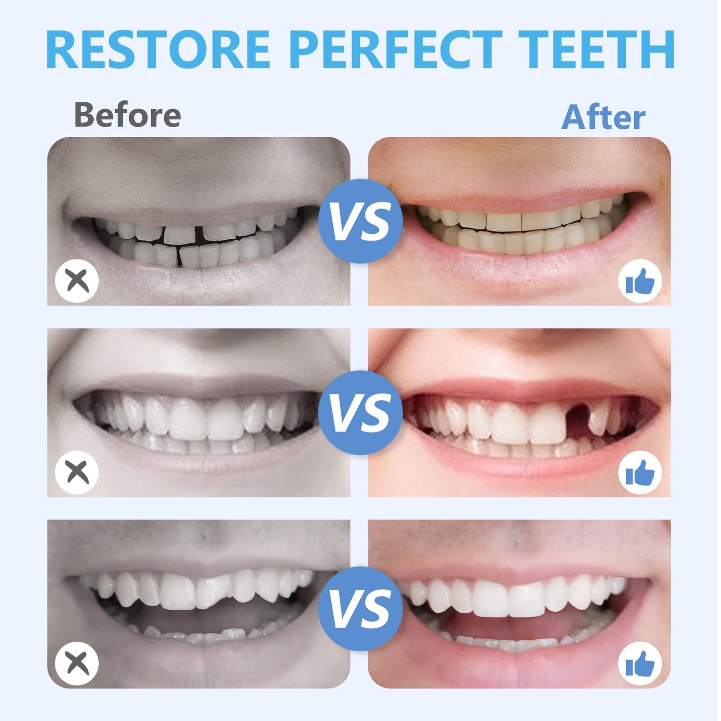 Tooth Repair Kit, Moldable Tooth Repair Kit for Broken Teeth Fixing & Missing Teeth Replacement, Safe & Effective Kit with 4 Dental Tools and 30 ml Repair Beads