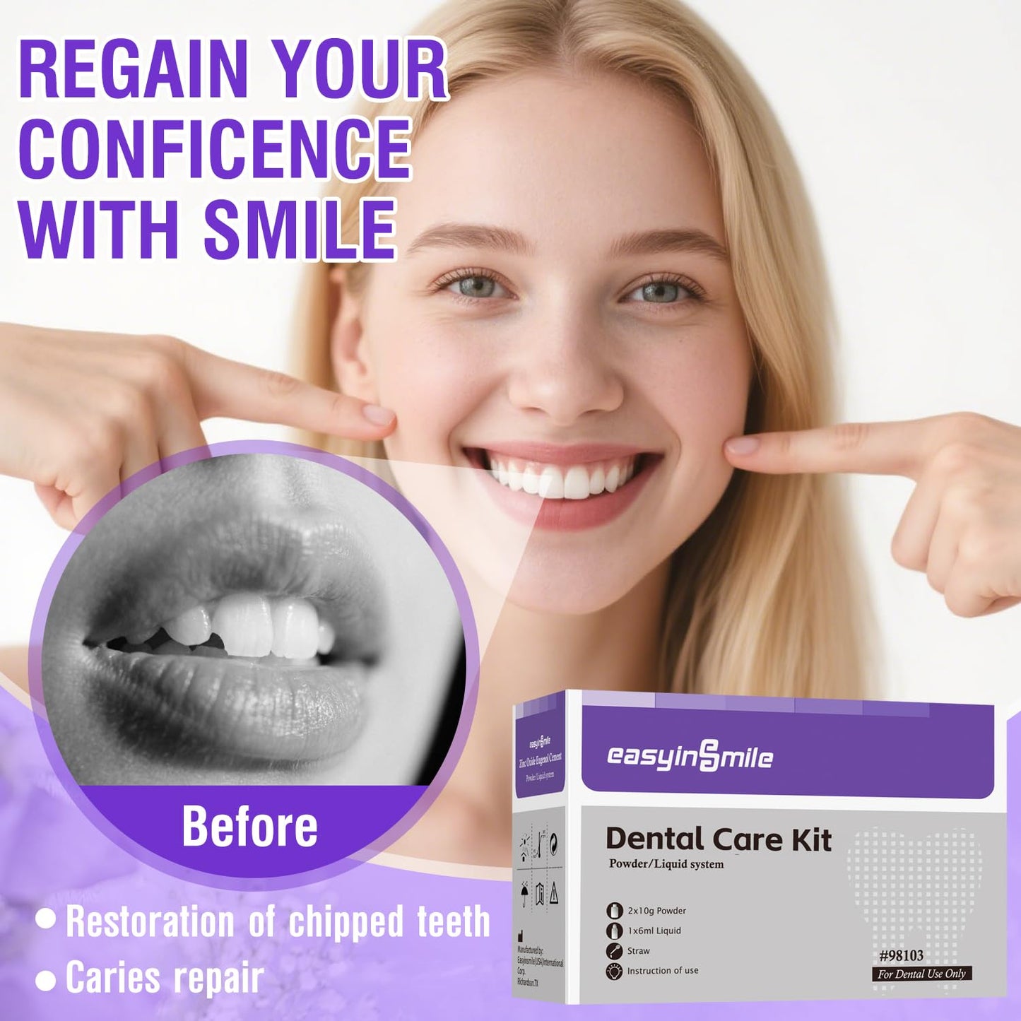 Dental Cement Temporary Tooth Repair Kit for Broken Teeth, Zinc Oxide Eugenol Glue for Chipped Missing Teeth,Crowns, Fillings & Bridges