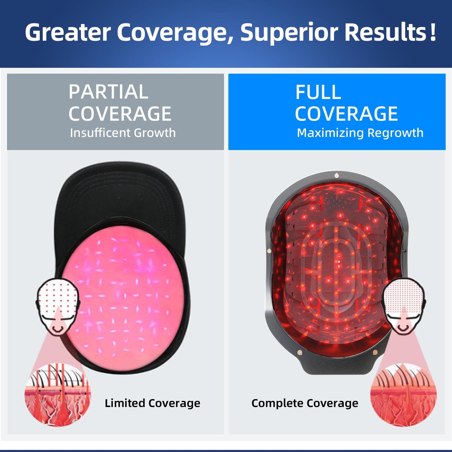 Hair Growth Device with Laser Red Light Therapy, FDA Cleared Hair Loss, Hair Thinning & Alopecia Treatment for Men & Women, Hair Regrowth Laser Cap