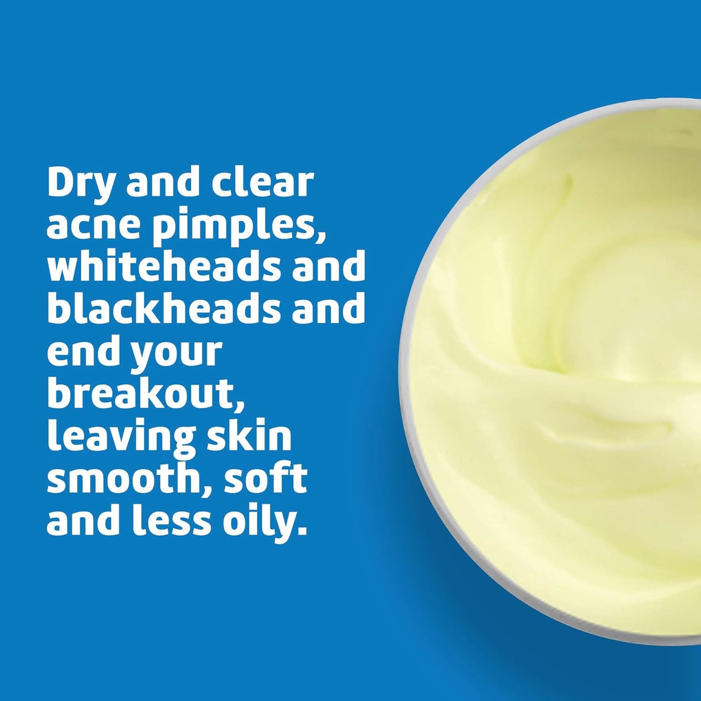 De La Cruz 5% Sulfur Ointment - Cystic Acne Treatment for Face and Body - Daily 10 Min Spot Treatment Mask - Safe and Effective Game Changing Hormonal Acne Treatment that Clears Up Pimples 2.6oz Tube