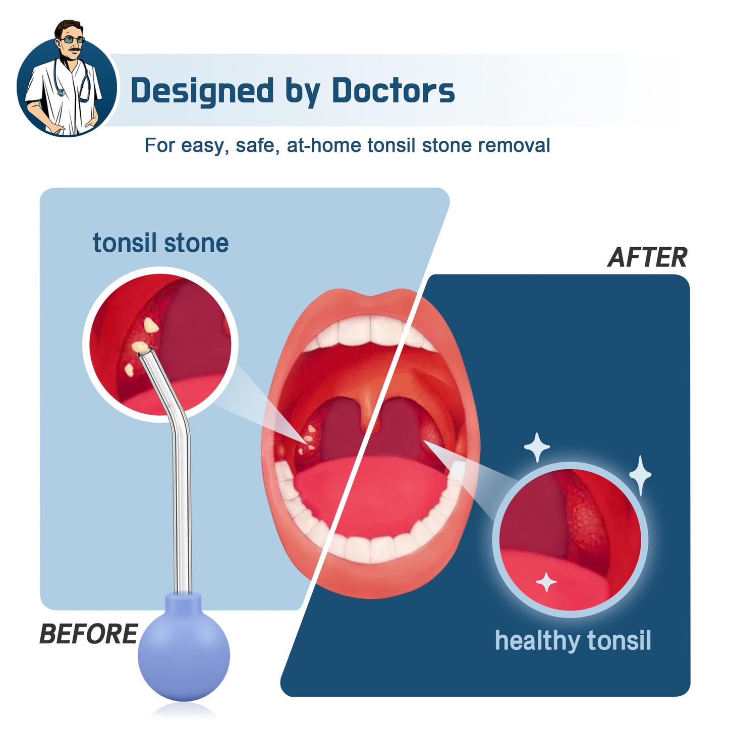 Tonsil Stone Vacuum, 9 Pcs Tonsil Stone Remover, Tonsil Stone Removal kit Vacuum Suction, Tonsil Stone Cupping Tool, Tonsil Stone Removal Tool with Oral Light, 5X Magnifying Mirror, Tongue Depressor