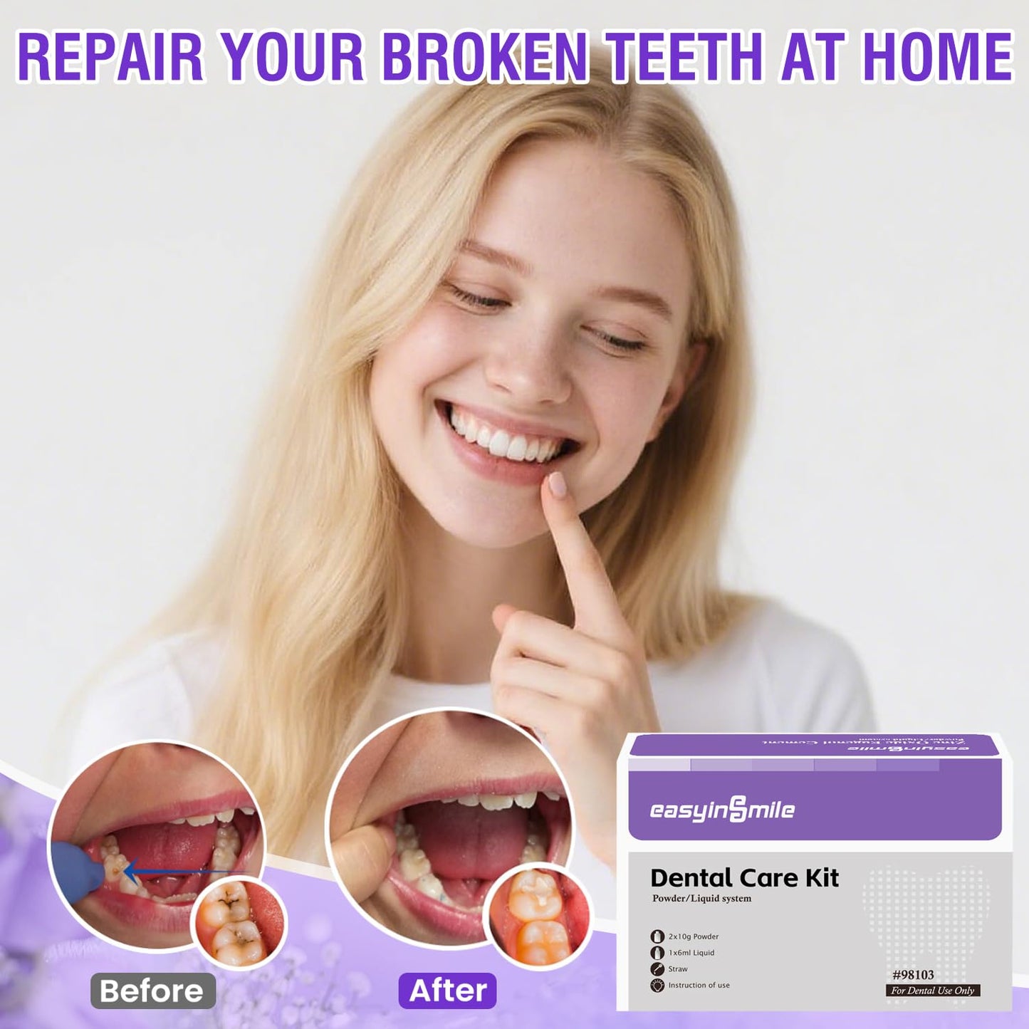 Dental Cement Temporary Tooth Repair Kit for Broken Teeth, Zinc Oxide Eugenol Glue for Chipped Missing Teeth,Crowns, Fillings & Bridges