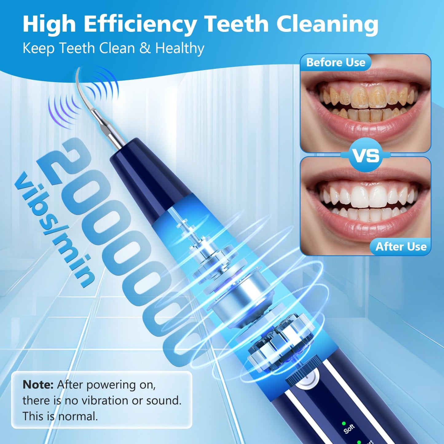 lovewo Plaque Remover for Teeth, Teeth Cleaning Tools with LED Light Tartar Remover 5 Modes Teeth Cleaning Kit, Blue