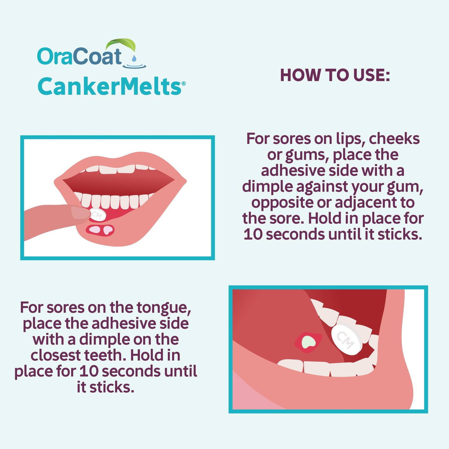Oracoat CankerMelts Canker Sore Treatment - Stick-On Pain Relief Melts for Fast Acting Relief Inside Mouth with Benzocaine, Hyaluronic Acid & Vitamin B12, Pack of 20