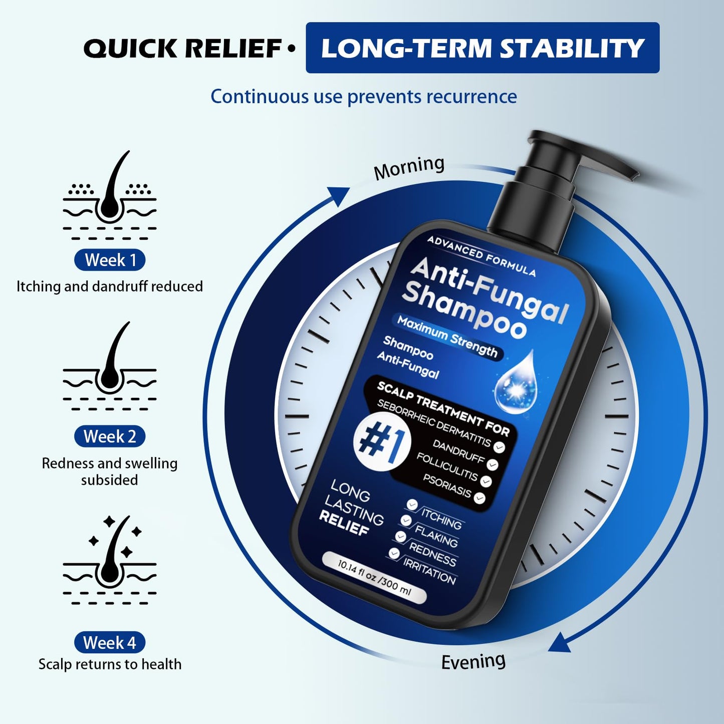 Antifungal Shampoo for Seborrheic Dermatitis, Folliculitis & Scalp Psoriasis, Anti-Dandruff Shampoo for Men & Women, Relieves Scalp Itching, Dryness, Sulfate & Paraben-Free, 10.1 Fl Oz