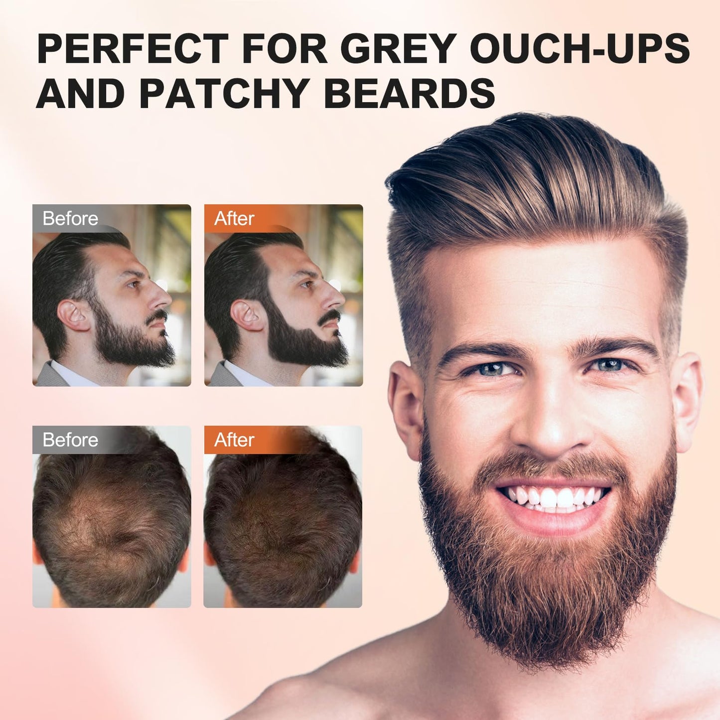 Acosexy Root Touch Up Powder, Hairline Shadow Concealer for Women's Eyebrows and Men's Beard Lines, Covers Bald Spots (Medium Brown)