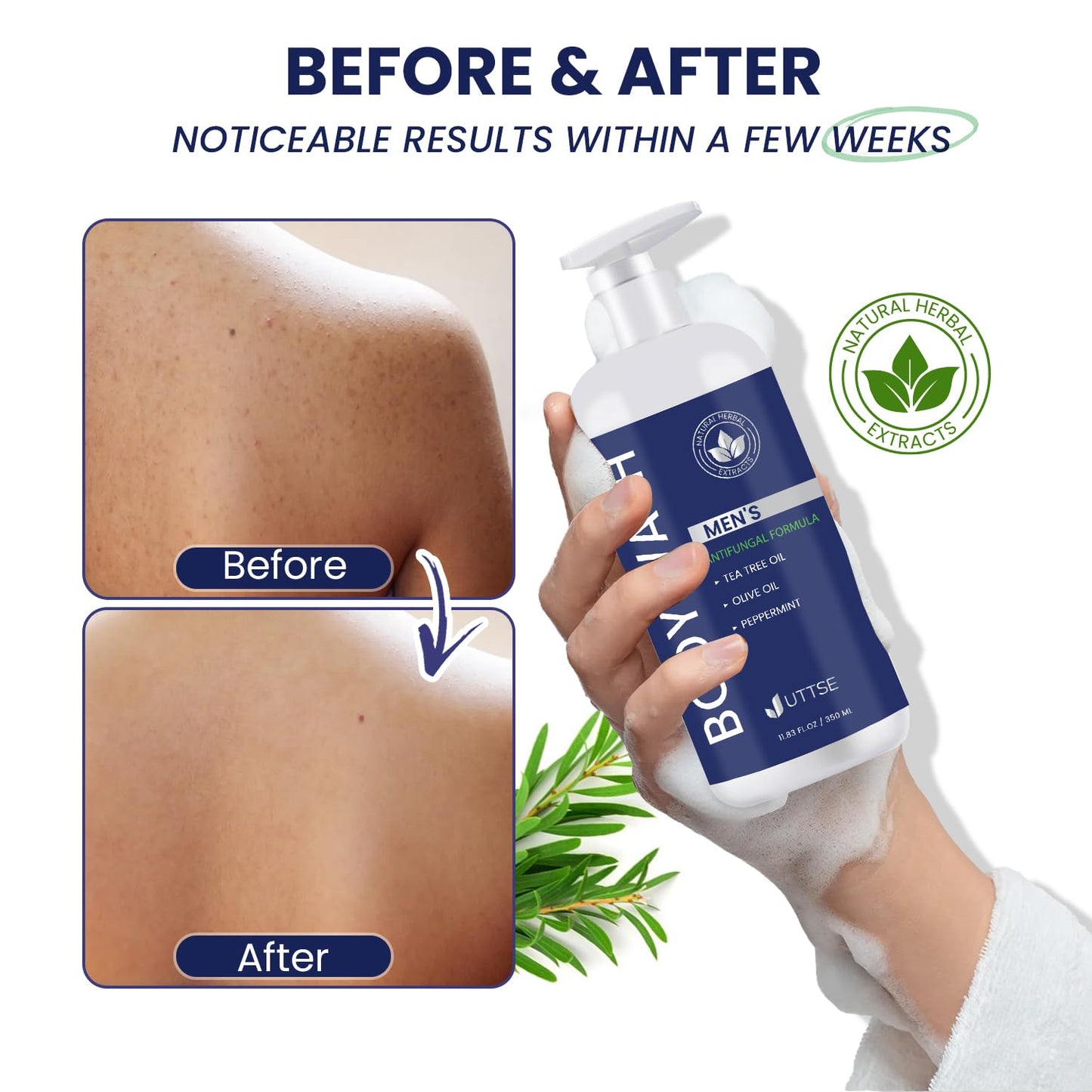 Uttse Tea Tree Body Wash: Antifungal Soap for Men - Eliminates Body Odors & Skin Irritations - 11.8fl oz/350mL