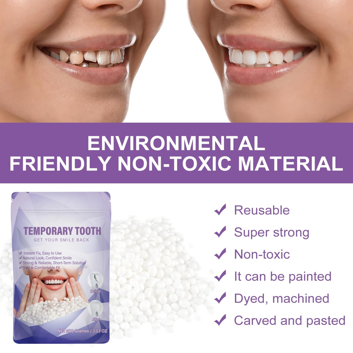 Tooth Repair Kit,Moldable Beads for Teeth Repair,DIY Tooth Filling Repair Kit Fixing The Missing and Broken Replacements, DIY Natural Filling Fake Teeth,Smile Confidently Again(100 Grams)-B01