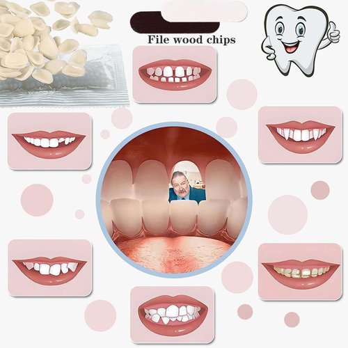 VEZE Tooth Repair Kit-Thermal Fitting Beads Granules and Fake Teeth for Temporary Fixing Missing and Broken Tooth, Moldable Fake Teeth and Thermal Beads Replacement Kit.【Teeth - Piece Yellow】