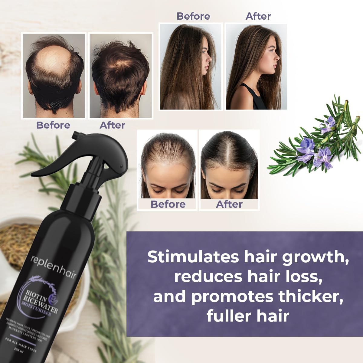 Replenhair Rice Water Biotin Hair Growth Spray - Leave In Conditioner Infused with Biotin Oil & Essential Oil for Hair Growth, Reduces Hair Fall, Dandruff & Promotes Thicker Hair - 250ml