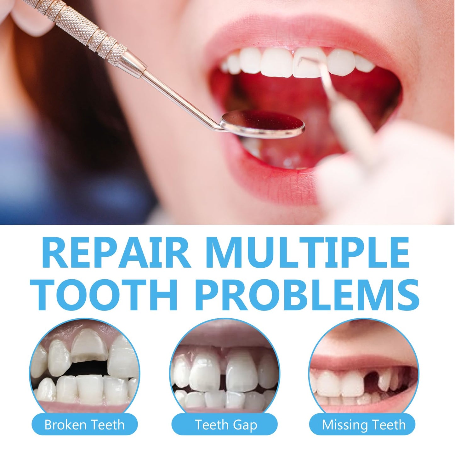 Tooth Repair Kit, Moldable Tooth Repair Kit for Broken Teeth Fixing & Missing Teeth Replacement, Safe & Effective Kit with 4 Dental Tools and 30 ml Repair Beads