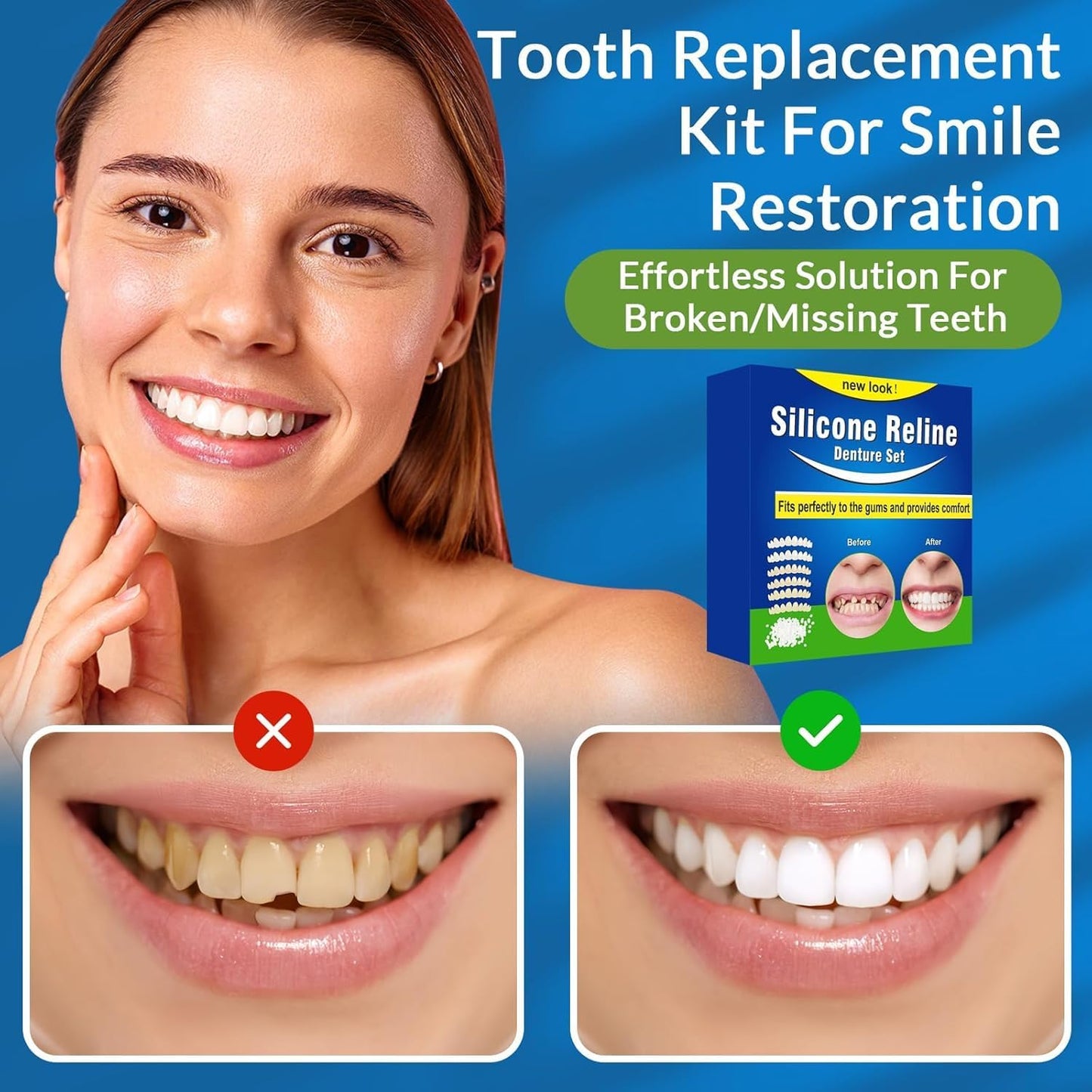 Veneers Teeth for Women, Tooth Replacement Missing Teeth, Upper Veneer Cosmetic Tooth, Moldable Thermal Beads Replacement Kit, Unisex to Denture Repair Kit, 6PCS