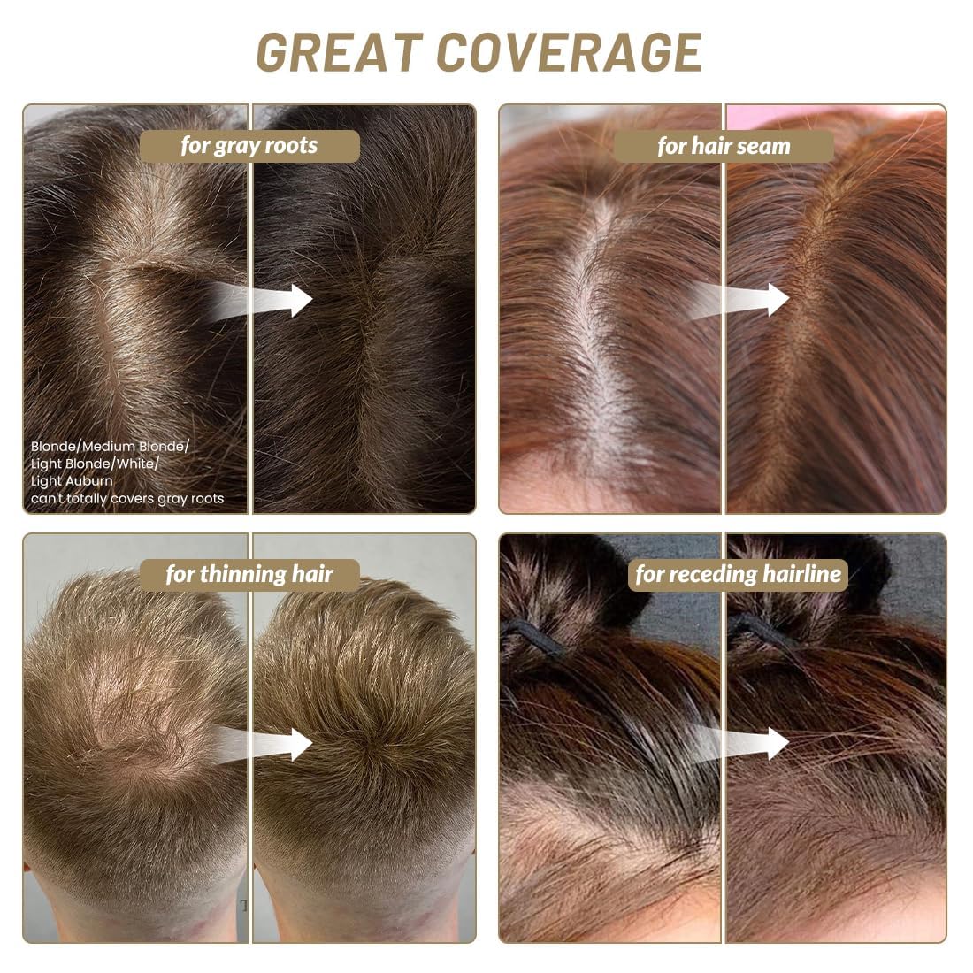 SOVONCARE Instantly Hairline Powder, Hairline Shadow Gray Hair Coverage Touch Up Hair Powder for Thinning Hair for Women Hair Root Touch Up Powder Hair Root Cover Up Conceals Hair Loss Dark Brown