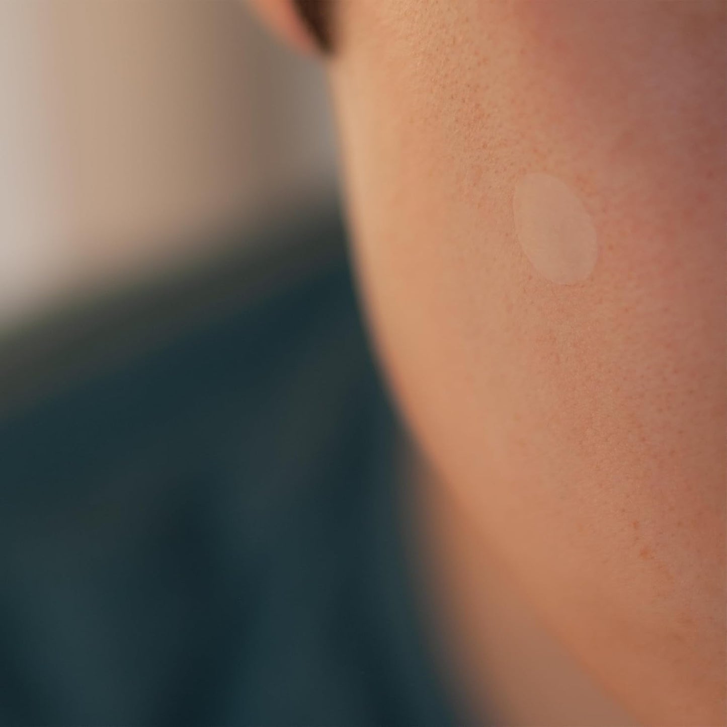 Hydrocolloid Acne Treatment Dots (120 Count) | Clear Waterproof Blemish Patches