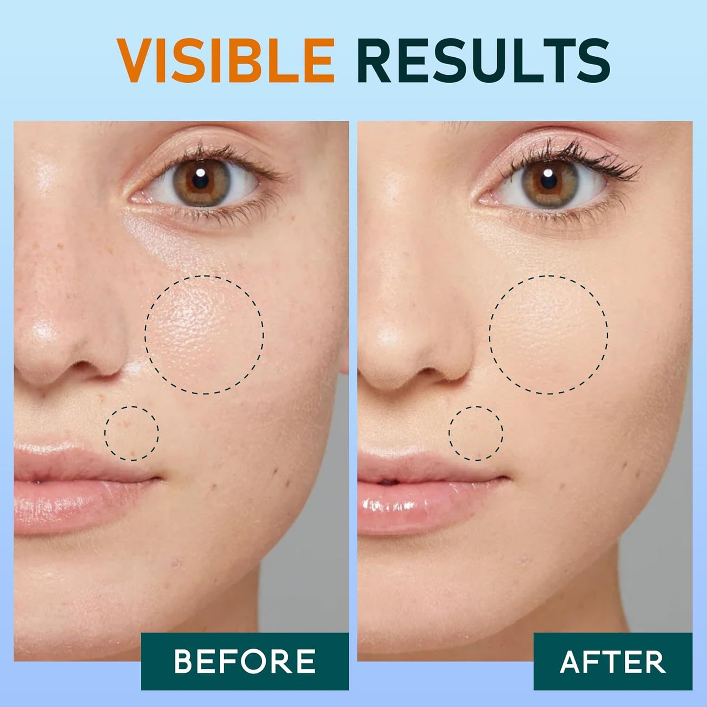 Turmeric Cleansing Pads with Kojic Acid - 80 Exfoliating & Hydrating Pads for Face