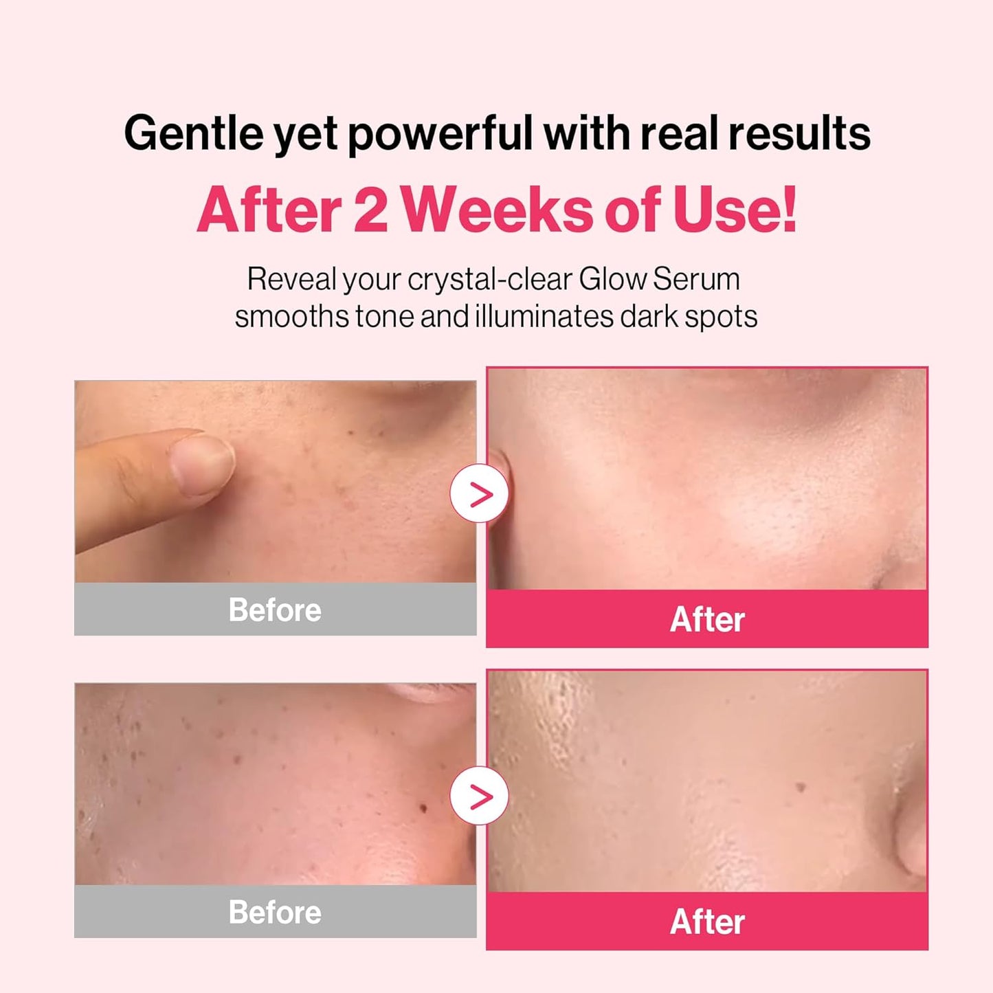 5% Niacinamide & Vitamin C Serum for Glowing Skin - Hydrating & Gentle for Sensitive Skin, 1 fl oz