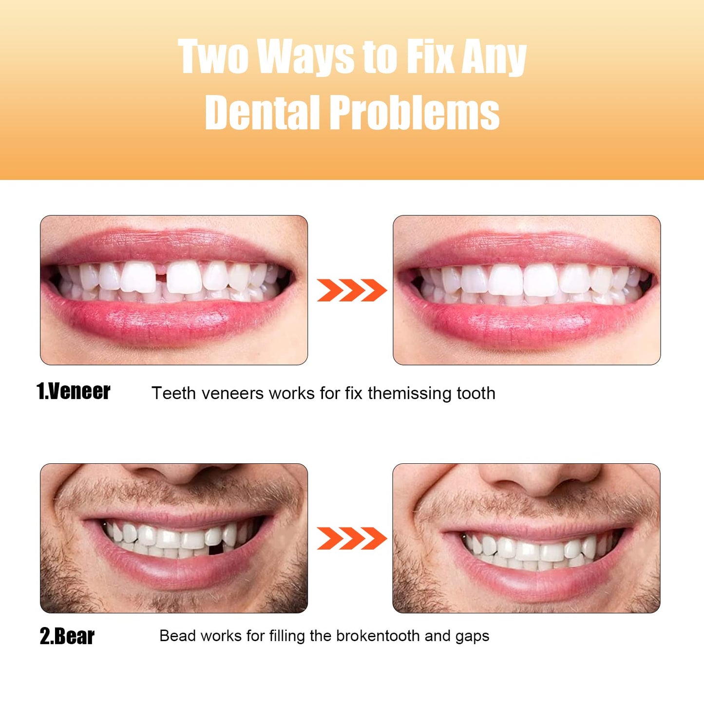 Tooth Repair kit,Teeth Repair Kit for Filling The Missing Broken Tooth and Gaps-Moldable Fake Teeth and Thermal Beads Temporary Replacement Kit-H001