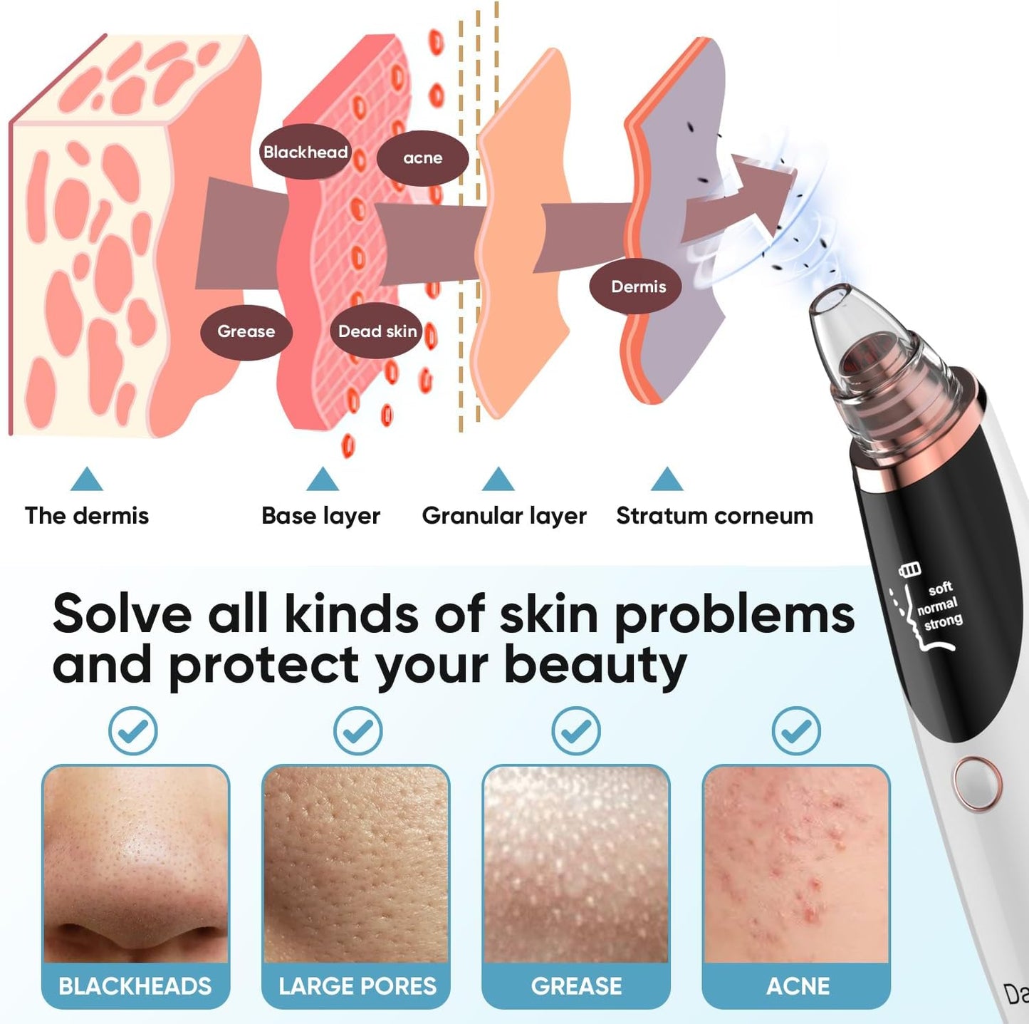Deep Cleansing Blackhead Remover Vacuum – USB Rechargeable Pore Cleaner with 3 Suction Levels & 5 Tips
