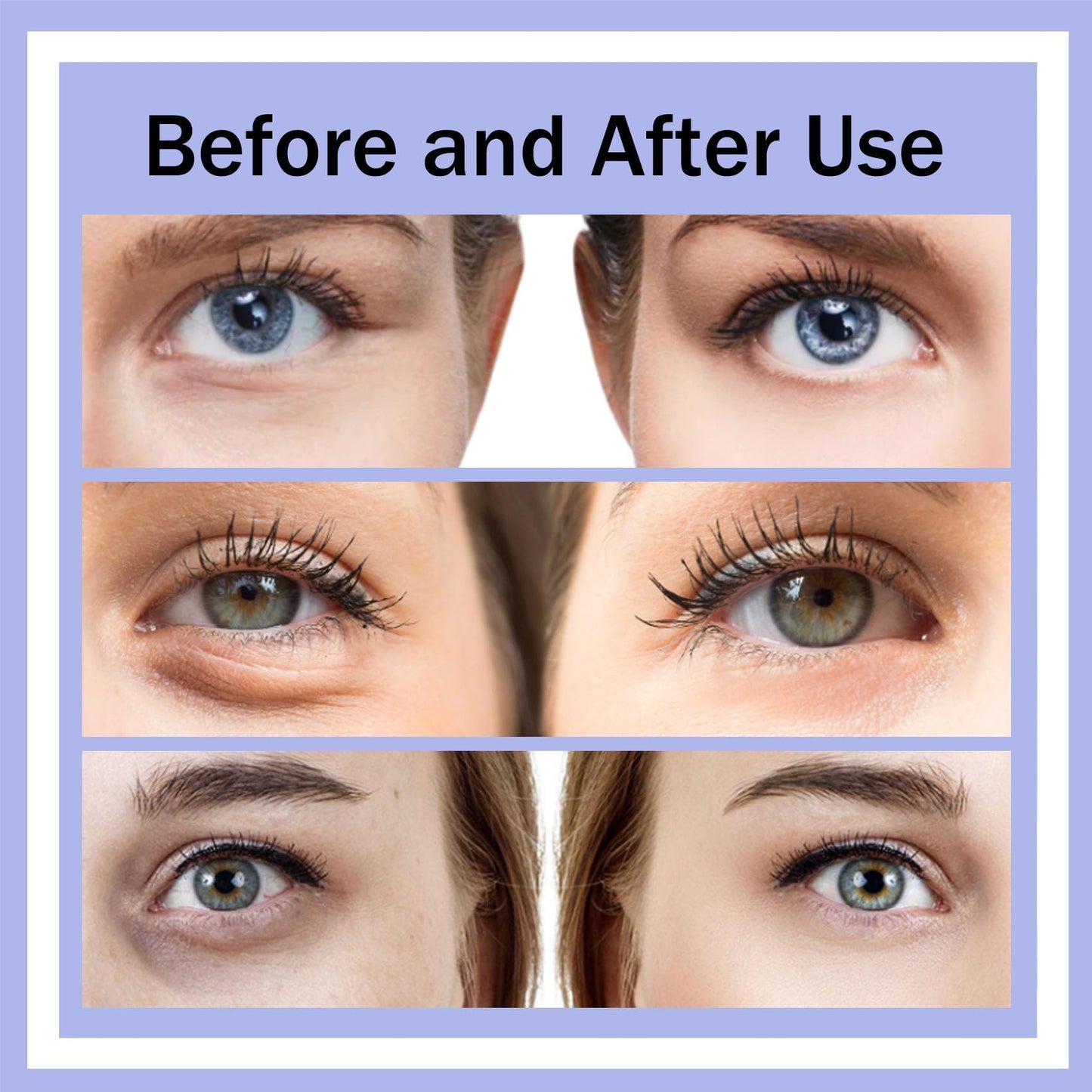 Renewa Eyelift Device, Eye Bag Remover Glasses for Remove Dark Circles, Eyelift Device Bag Remover Quickly Remove, Puffy Eyes Bags in 21 Days, Reduce Fine Lines (#A)