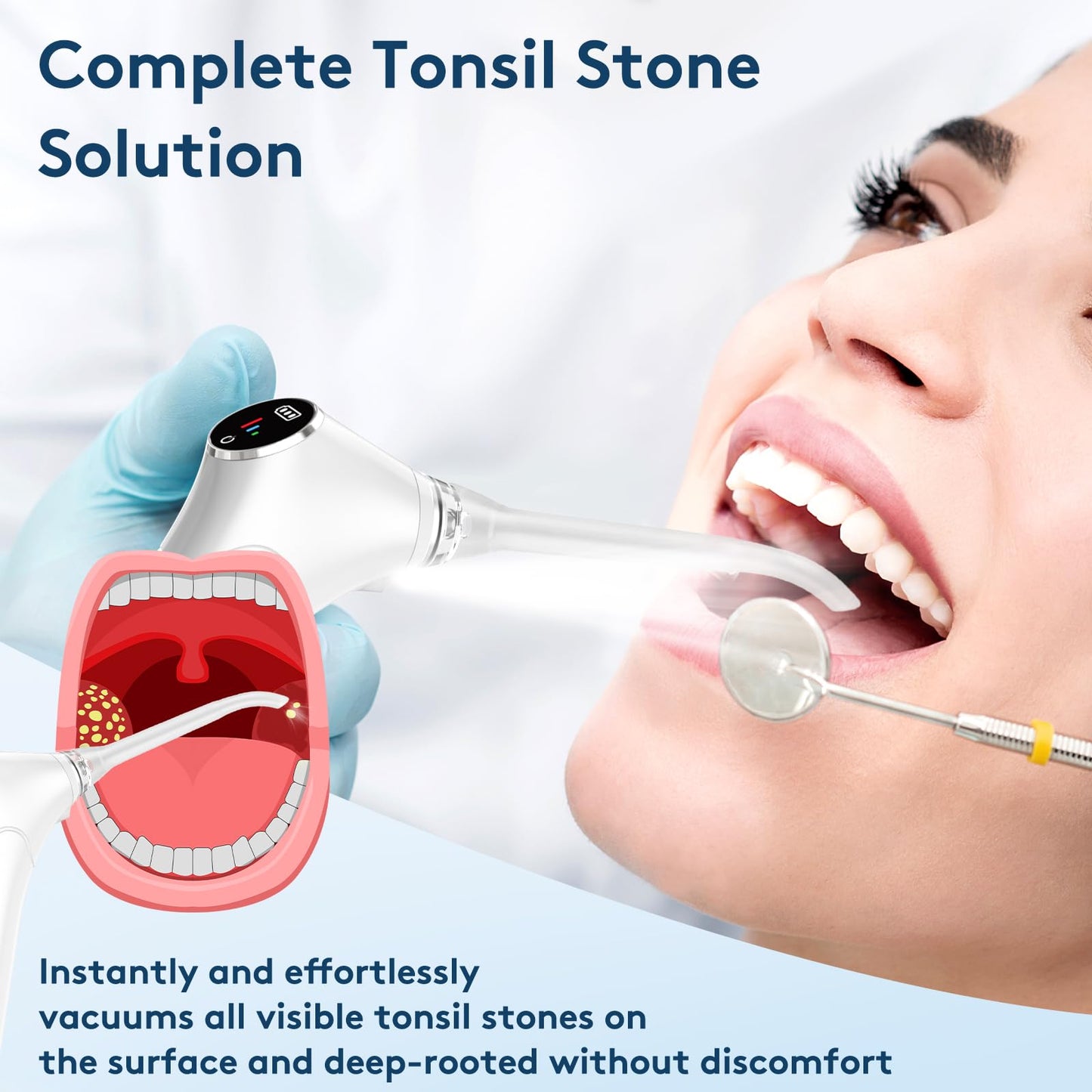 Tonsil Stone Remover Kit - Electronic Tonsil Stone Vacuum with Built-in LED Light - Tonsil Stone Removal Kit with 3 Levels Suction - Instant Suction - Irrigator and 5X Magnifying Mirror (White)