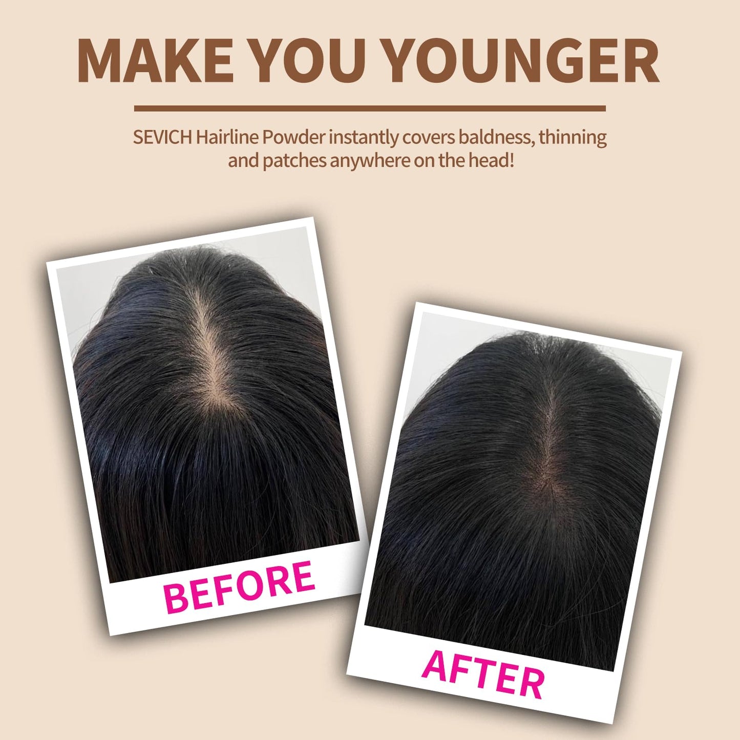 SEVICH Instantly Hairline Shadow Hairline Powder, Quick Cover Grey Hair Root Concealer, Eyebrows & Beard Line, Hair Root Touch Up for Thinning Grey Hairline, Windproof&Sweatproof, Dark Brown
