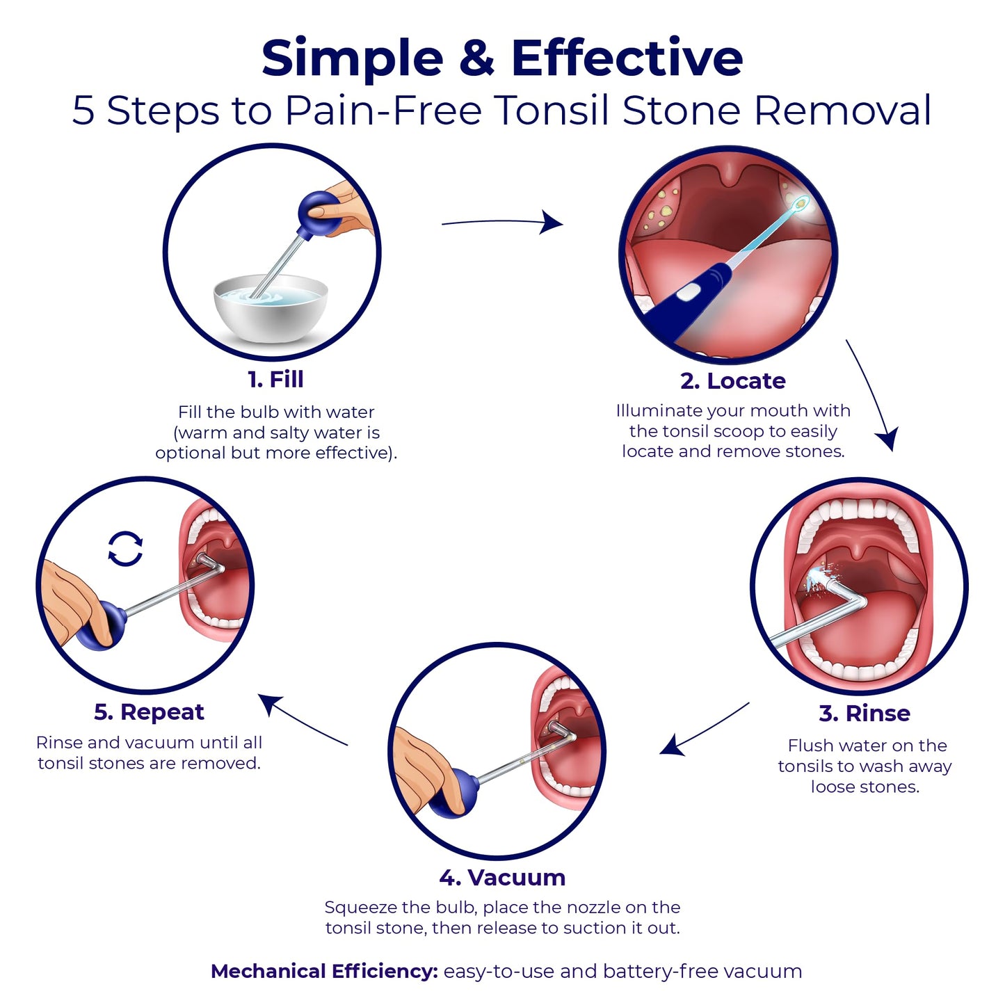 Oravix Tonsil Stone Vacuum, Tonsil Stone Remover Vacuum Suction, Tonsil Stone Cupping Tool, Tonsil Stone Removal Tool with Suction, Tonsil Stones Removal Vacuum, Tonsil Stone Extractor - 3 in 1 Kit